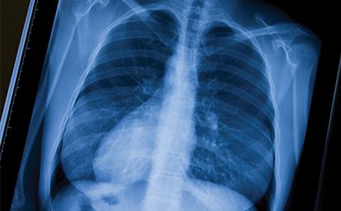 X Ray